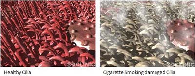 cilila normal vs smoker
